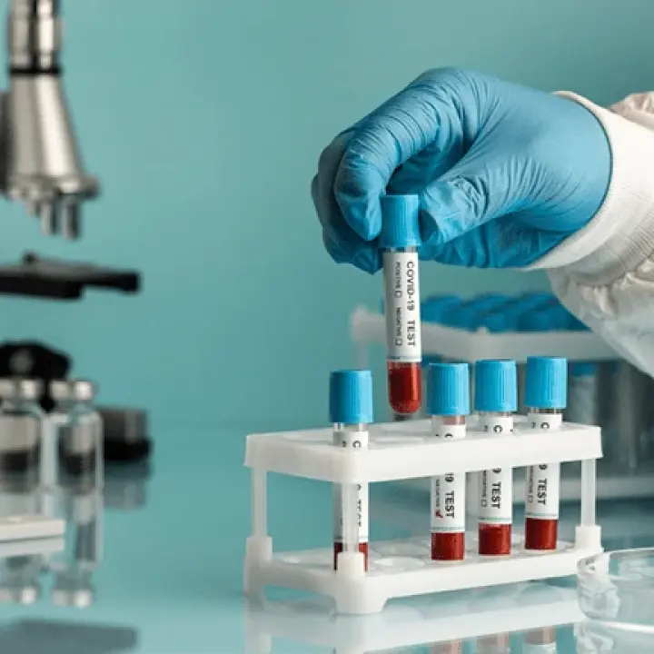 🧪 Common Medical Tests and Their Meanings (জনপ্রিয় স্বাস্থ্য পরীক্ষাগুলো ও তাদের অর্থ)