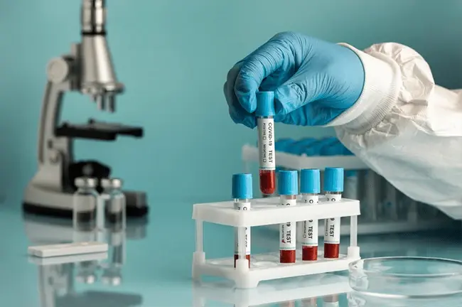🧪 Common Medical Tests and Their Meanings (জনপ্রিয় স্বাস্থ্য পরীক্ষাগুলো ও তাদের অর্থ)