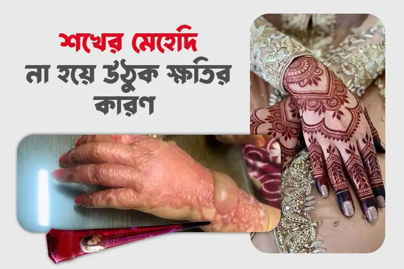 শখের মেহেদি থেকে হতে পারে ভয়ঙ্কর শারীরিক সমস্যা!
